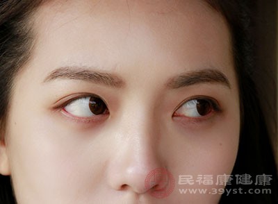 久病体弱或大病初愈由于眼周围皮下组织薄弱