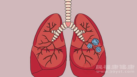 肺結(jié)節(jié)屬于是一種常見的疾病，結(jié)節(jié)較小的患者可能沒有任何明顯的癥狀