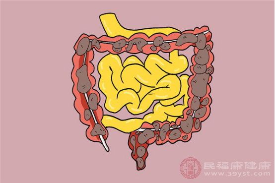 清除宿便最快的方法就是灌腸