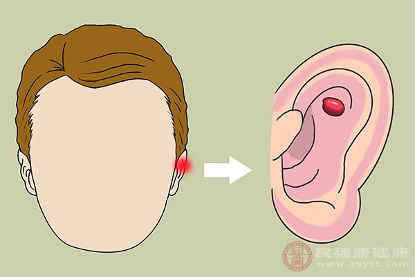 当耳朵总是感觉有东西在晃动或者有声响时，大多数情况下，都是因为患者的耳朵里有异物的存在