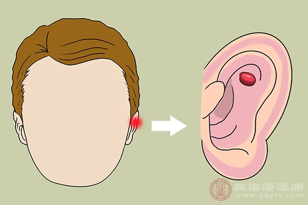 很多的蚊虫都是有毒性的,一般被蚊虫叮咬过的部位会出现肿大 很多的蚊虫都是有毒性的,一般被蚊虫叮咬过的部位会出现肿大