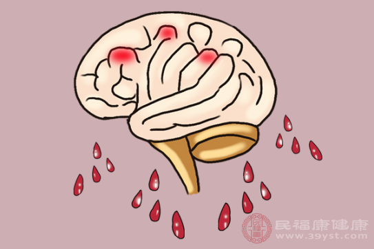 脑出血的情况，主要是由于各种脑部是受到重击引起