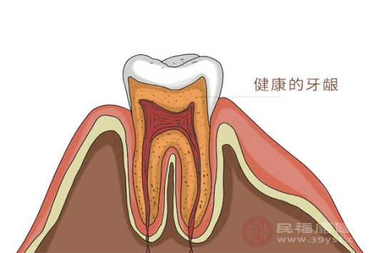 牙龈癌的早期三大症状分别是什么