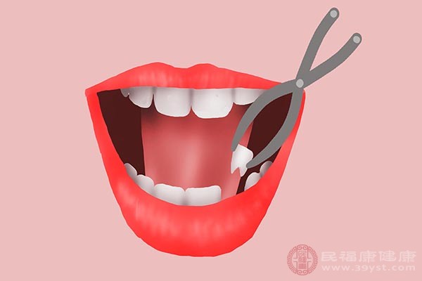 血液止住后，口腔内可能会有血腥味，但是这时不能用刷牙、漱口等方式清除这些血腥味