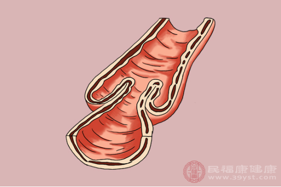 急性腸胃炎的癥狀包括嘔吐、腹瀉、頭暈等，而且發(fā)病非常倉(cāng)促