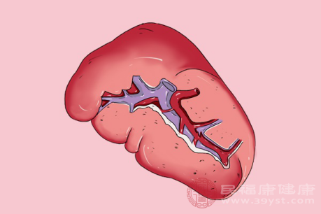 脾中醫(yī)中主要指氣血運(yùn)行，一旦它出現(xiàn)腫大導(dǎo)致正常功能受損