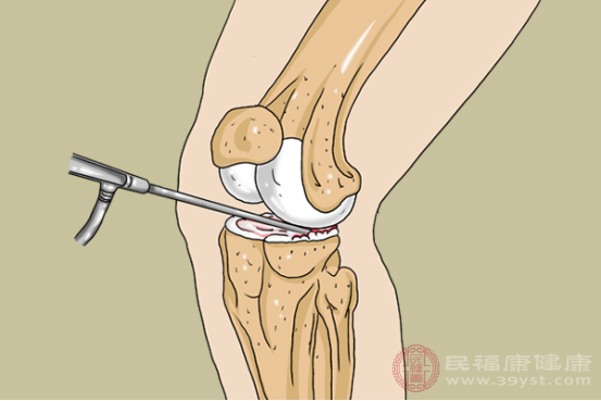 通過手術(shù)的方式，可以更快的幫助半月板受損部位得到有效的恢復(fù)