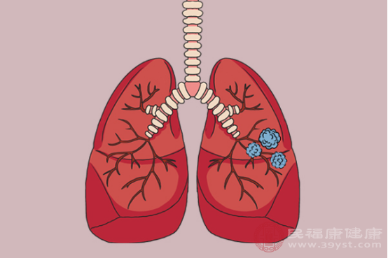 肺部結(jié)節(jié)其實就是肺部的不規(guī)則的病灶，肺部結(jié)節(jié)可能是日常呼吸系統(tǒng)的一種免疫功能的表現(xiàn)