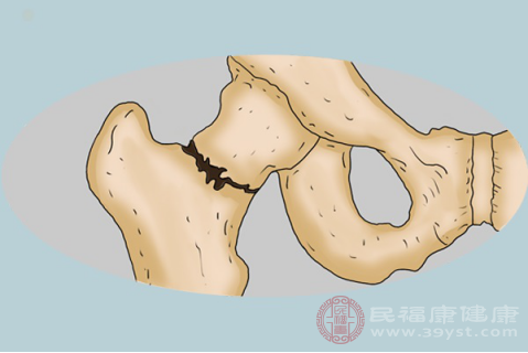 該疾病主要患病人群是青年女性朋友，因?yàn)橹斡赡苄员容^小