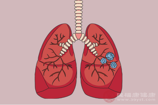 如果患者的肺部本身就患有疾病，在早期階段也有可能會出現(xiàn)結(jié)節(jié)