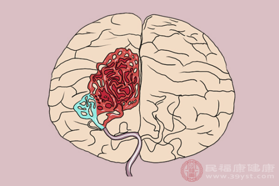 我們可以根據(jù)腦出血患者的癥狀，來判斷出血的部位