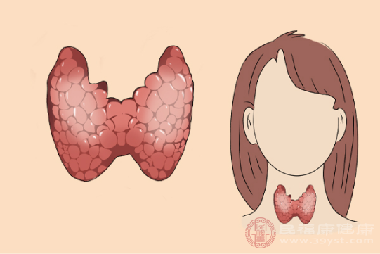 促甲状腺激素增加、甲状腺激素降低的患者可能有皮肤干燥