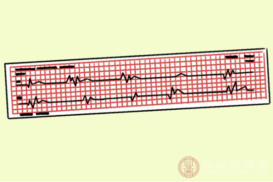 做過(guò)心電圖的人應(yīng)該都知道，心電圖的檢測(cè)報(bào)告與其他的檢測(cè)報(bào)告會(huì)有所不同