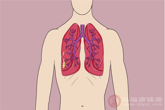 大部分肺結(jié)核患者都可以接受手術(shù)治療，切除感染灶，控制感染面積