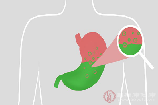 胃酸具有一定的腐蝕性，若是分泌過(guò)多會(huì)導(dǎo)致黏膜組織出現(xiàn)破潰