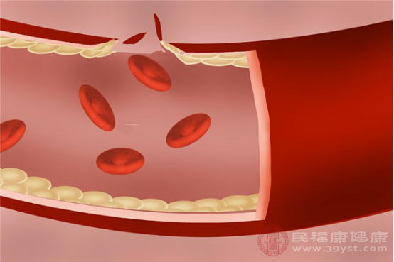 腦干出血患者能否恢復(fù)健康取決于患者的身體情況和搶救時(shí)間