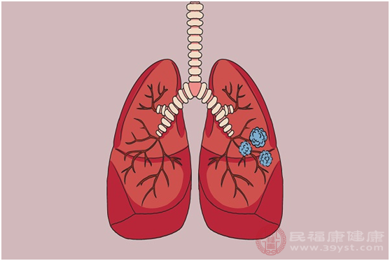 大部分患者都是通過特殊檢查了解肺部磨玻璃結(jié)節(jié)