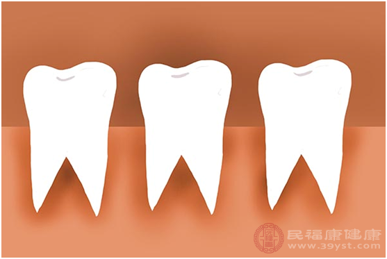 蛀牙就是我们日常生活中经常提起的虫牙