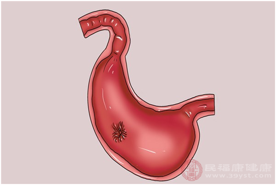 癌胚抗原升高幅度不大代表我们的身体内存在炎症反应