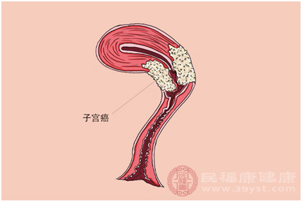 隨著年紀(jì)增長(zhǎng)細(xì)胞組織開始老化