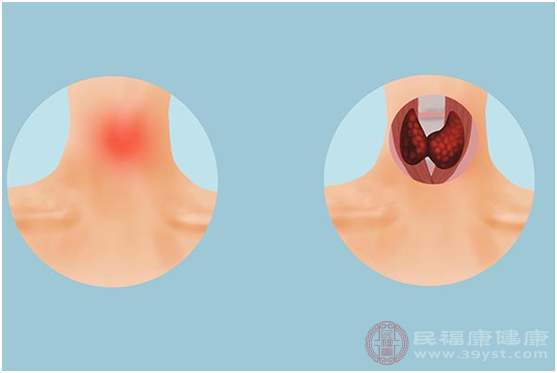 現(xiàn)在社會快速發(fā)展，大家生活壓力增大還有就是生活作息不規(guī)律的情況下