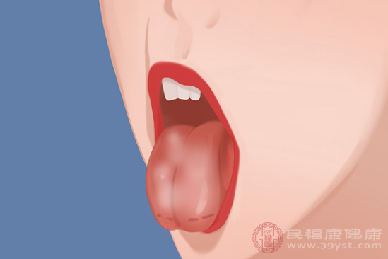 舌头发黄的原因有很多种，例如急性肠胃炎、胆囊炎和尿毒症等