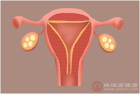 子宫内息肉是妇科疾病中发病率比较高的疾病