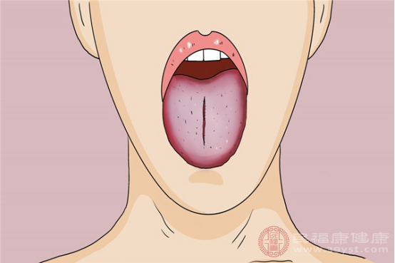 舌苔上有裂纹的原因包括病毒感染、干燥症和沟纹舌等