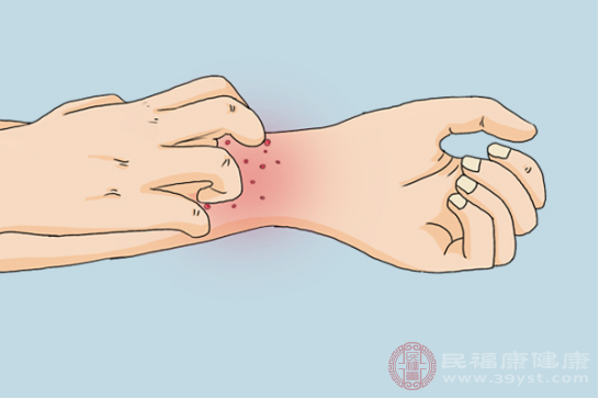 白癜風(fēng)患者早期能夠治愈，減少特殊因子對正常物質(zhì)的損害