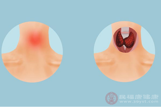 甲狀腺在人體結(jié)構(gòu)組織中，具有作用就是可以分泌激素