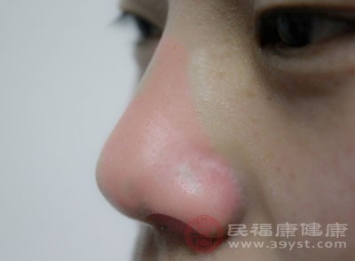 在出现了鼻塞的症状之后，可以拿着热毛巾放在鼻子的上面