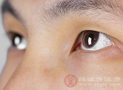 结膜充血明显，可能会导致眼睛红血丝非常多，这是疾病的信号之一