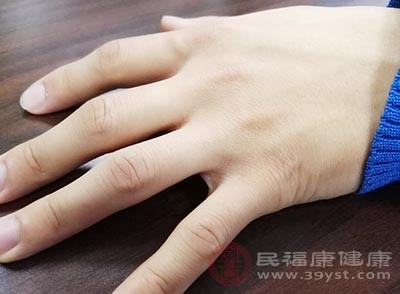 手被冻伤后可以用20到30度的温水浸泡双手