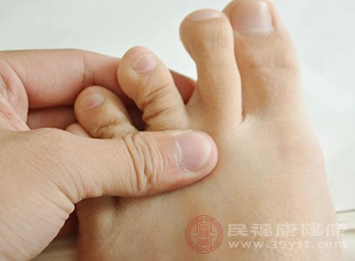 足癣的类型有很多，比如鳞屑角化型足癣、水疱型足癣