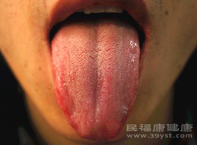 我们的舌头上有舌苔和舌质，舌苔在舌头的中间