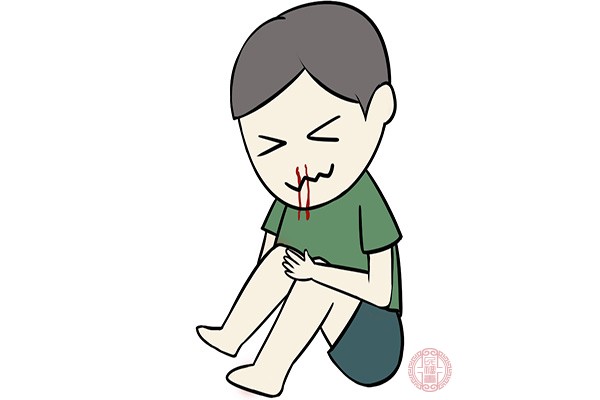 经常有流鼻血的症状最常见原因是鼻腔粘膜过于干燥