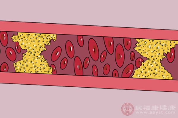 血栓主要是指血液中具有較多的雜質(zhì)，血液粘稠度比較高