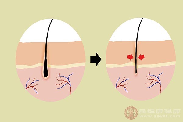 多按摩頭皮或者是用毛巾熱敷，促進(jìn)局部血液循環(huán)，加快毛囊組織的生長(zhǎng)發(fā)育