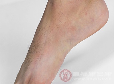 泡脚后腿部皮肤发红 可能是这种疾病导致的