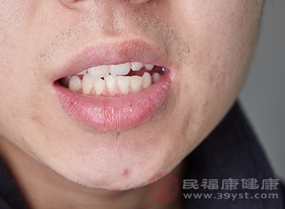 口腔清洁不干净非常容易产生牙结石