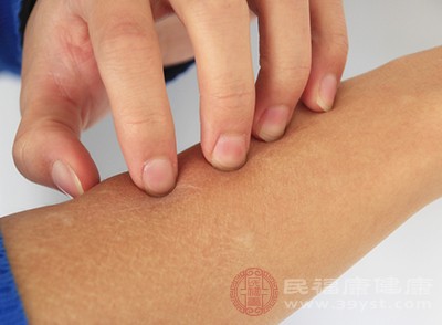 皮肤瘙痒可能和这5种疾病有关 千万别大意