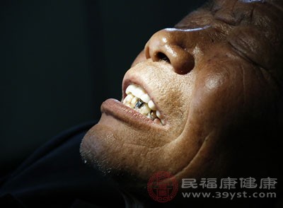 到了80岁残留的牙齿数量多于20颗才算健康