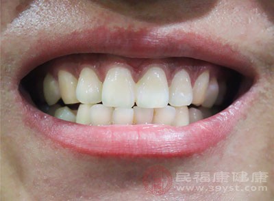 老年人容易遇到这4类牙齿问题 保护牙齿刻不容缓