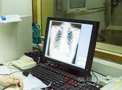 X線檢查是目前普及度高、應用為廣泛的一種醫學成像技術
