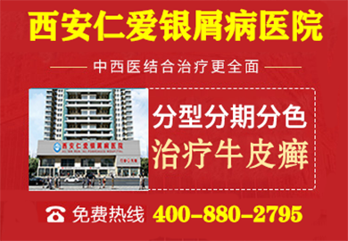 西安仁爱银屑病医院