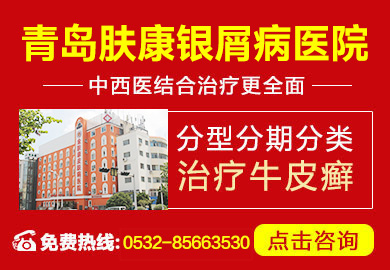 青岛银屑病医院