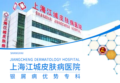 上海江城牛皮癣医院