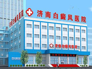 济南白癜风医院