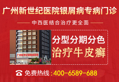 广州新世纪银屑病医院
