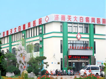 济南天大白癜风医院